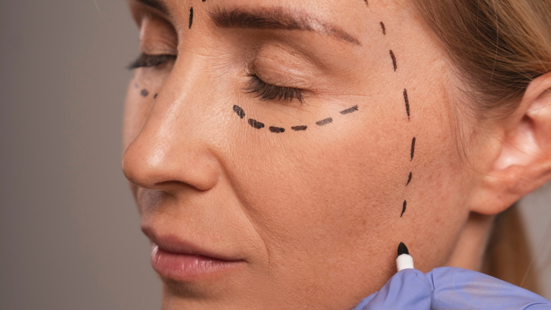 Paris, capitale de la beauté : découvrez pourquoi une clinique de chirurgie esthétique peut transformer votre apparence ?